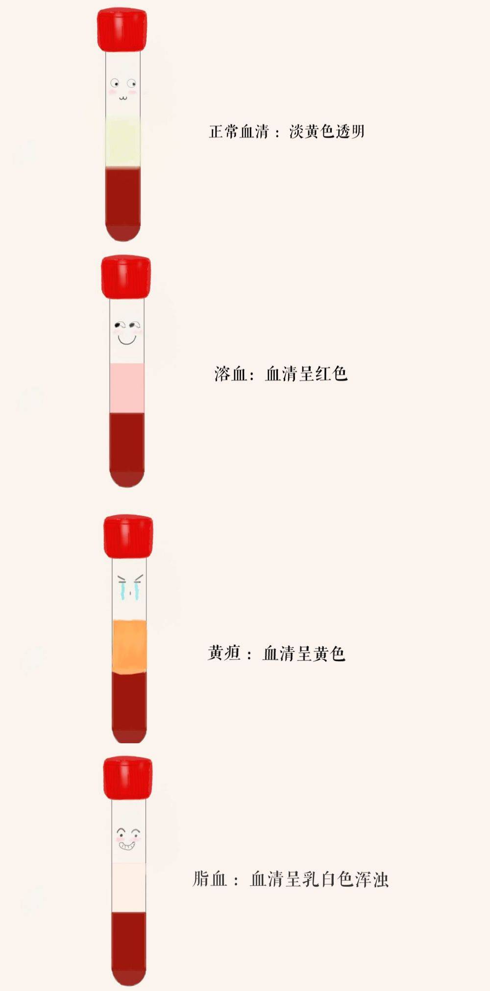 血清是血液离体凝固后分离出来的液体,主要用于化学和免疫学等检测
