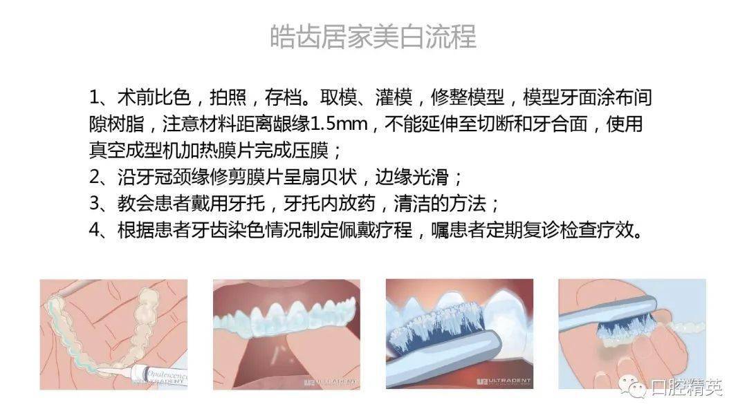 皓齿美白流程图片