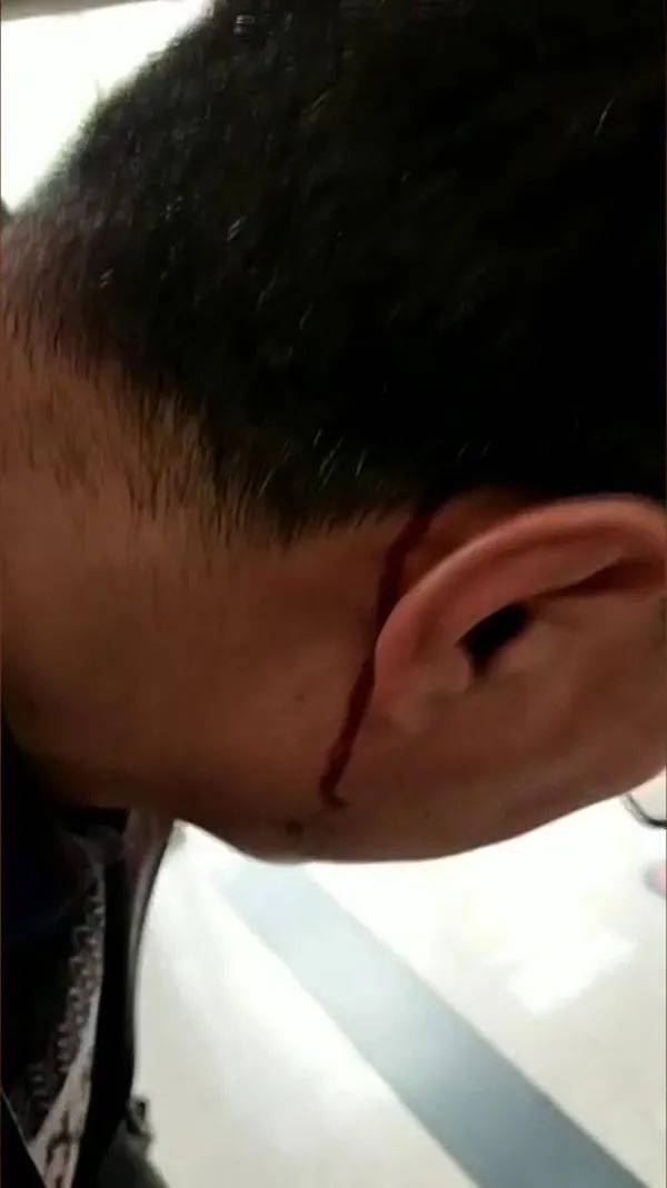 吓人无锡一地下停车场悬挂刀片真相到底是
