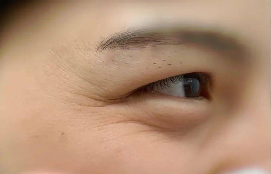 "八宝精髓"淡眼纹,眼周紧实又饱满_马应龙