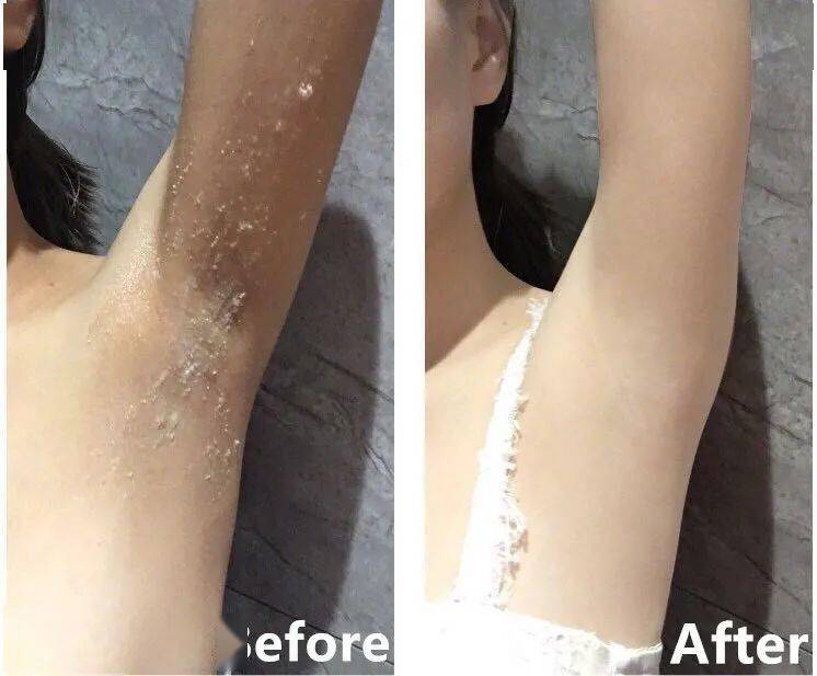 日本人给皮肤吃奶油,3秒排出"恶心绿泥",一次掏空毛孔污垢,爽翻了!