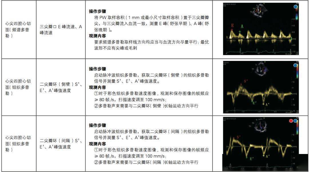 中国成人心力衰竭超声心动图规范化检查专家共识
