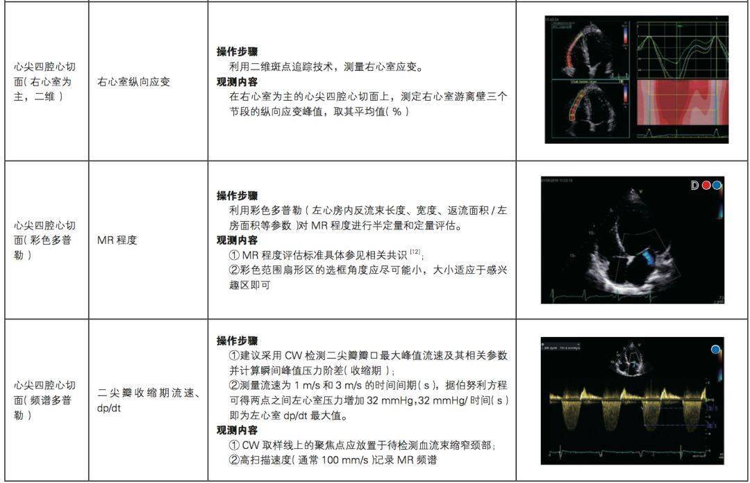 中国成人心力衰竭超声心动图规范化检查专家共识