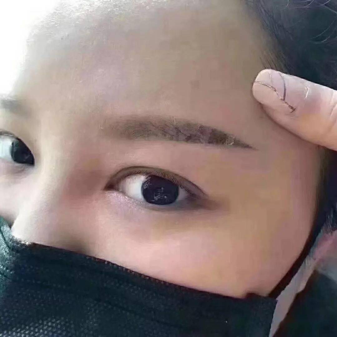 刚做的眉毛术后这几步一定要做好不然会掉色严重变色感染