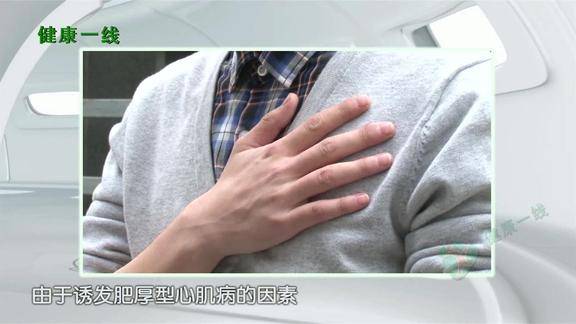 这一年龄段是肥厚型心肌病高发人群身体出现这些症状要立即就医