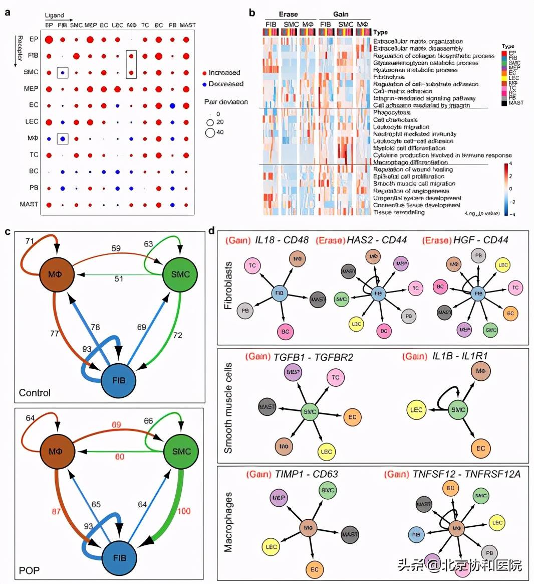 重磅协和朱兰团队绘制女性阴道前壁脱垂细胞图谱