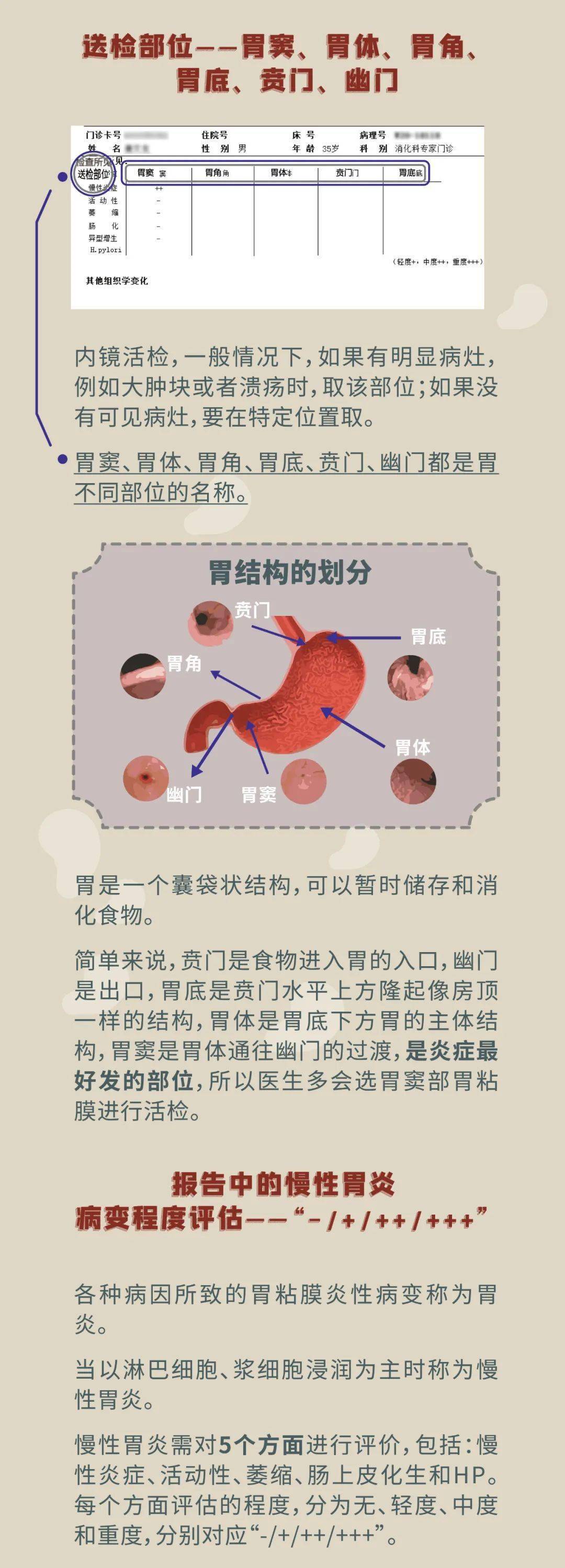 特色科普系列⑩市一病理科醫生深層剖析胃鏡病理報告的這些內涵你要懂