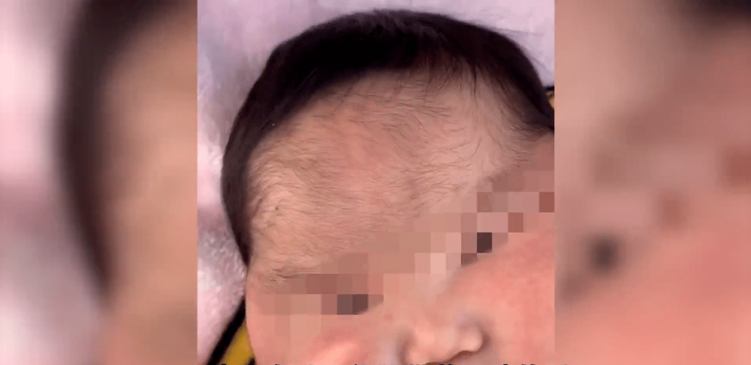 5月女婴被曝使用面霜后变大头娃娃脸硬得像石头相关部门已介入