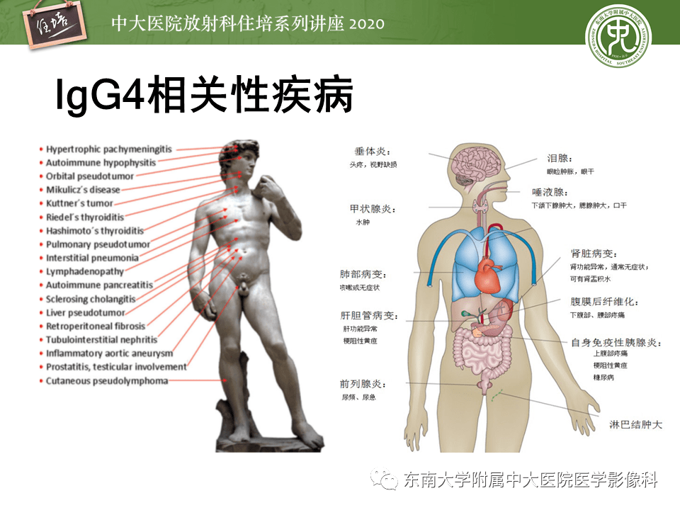 【中大放射住培系列講座】igg4相關性疾病腹部臟器累及影像表現