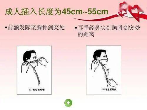 危管胃管为管