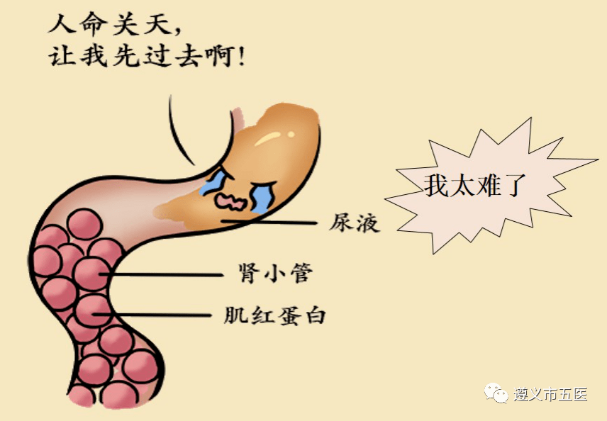 肌肉溶解症图片