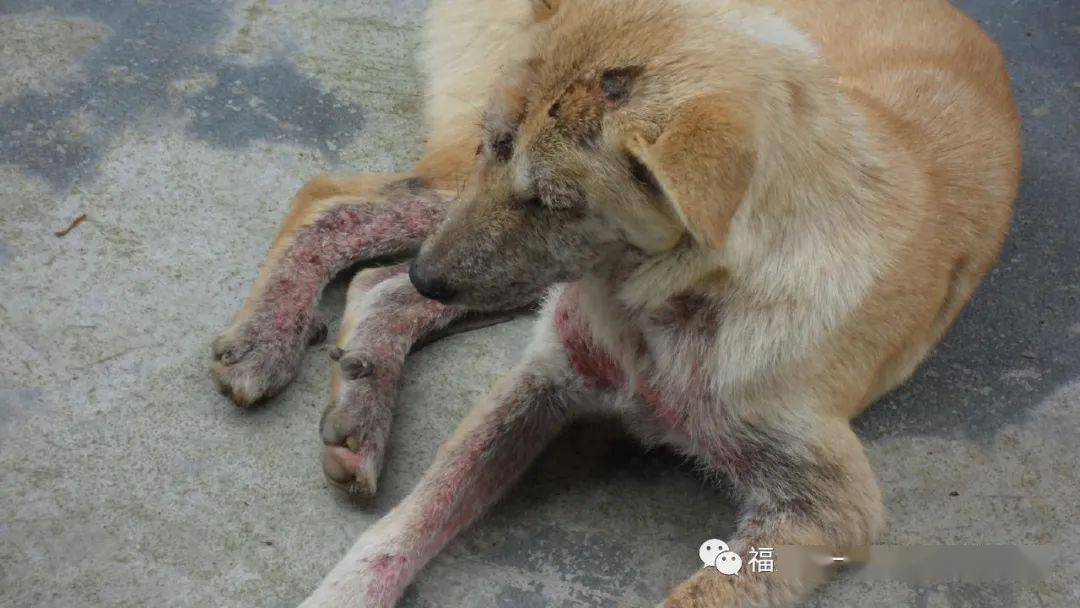 2,皮肤组织病理学:角质层轻度至中度化脓性血管周皮炎,可见角质层内或