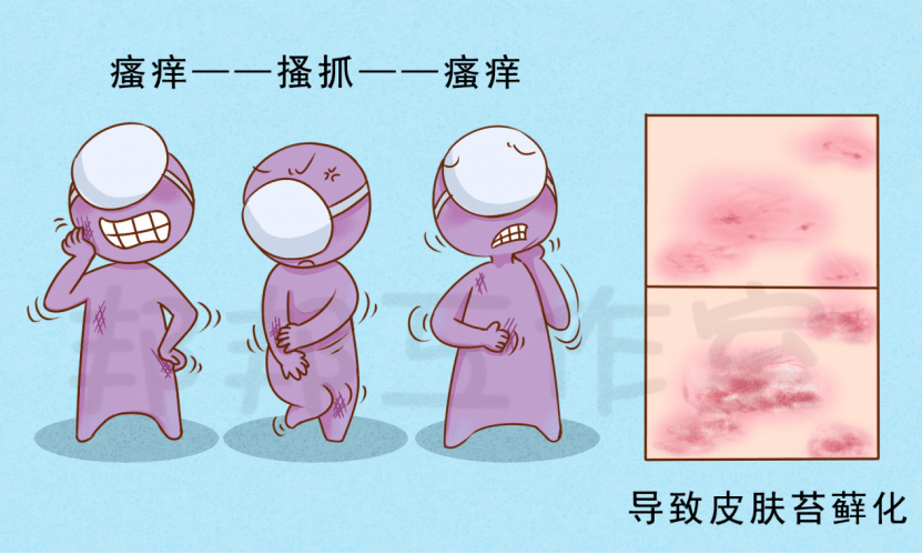 外阴白斑苔藓症状图片图片