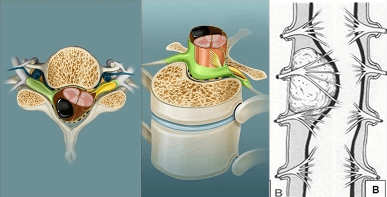 神经脊髓脊柱外科是神经外科