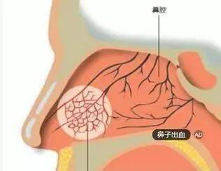 心脏病人口吐是什么征兆_脚底发紫黑是什么征兆(2)