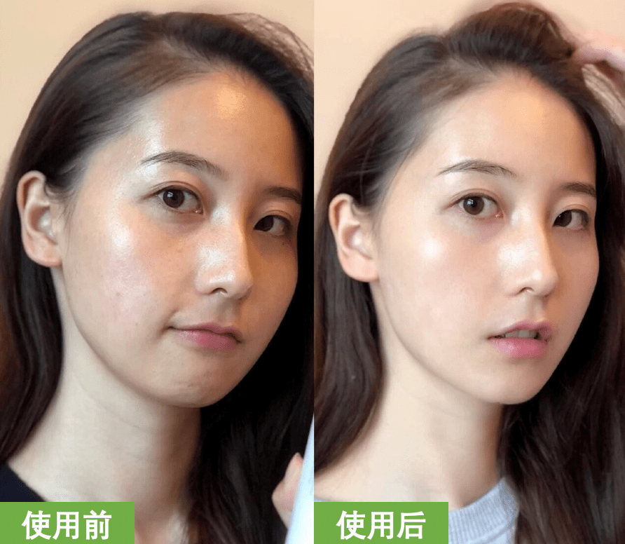 怎样让脸部的肉更饱满 2fad1982954348f991f5ae97b04d4b94.png