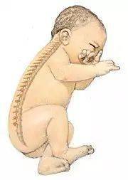 宝宝几个月会坐立自如 7f188d91e0dc430f8989e9dddab2b24b.jpeg