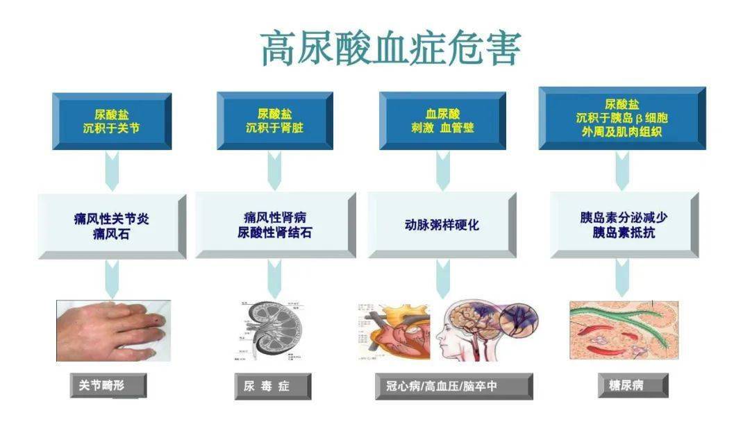 難治性痛風治療的指南依據