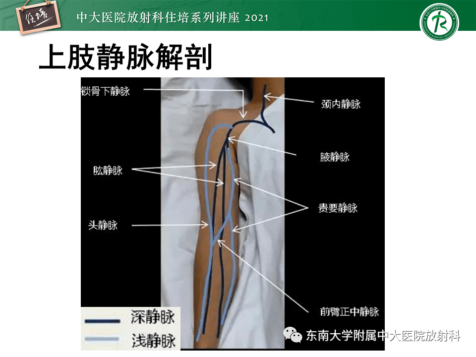 中大放射住培系列讲座上肢动静脉解剖及人工动静脉造瘘