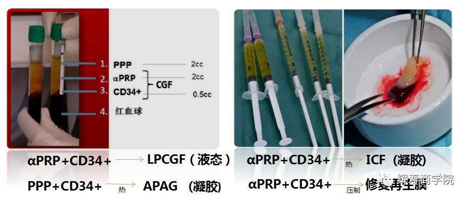 一部分液体,含有生长因子,白细胞系,等待刺激的干细胞和以专业区分的