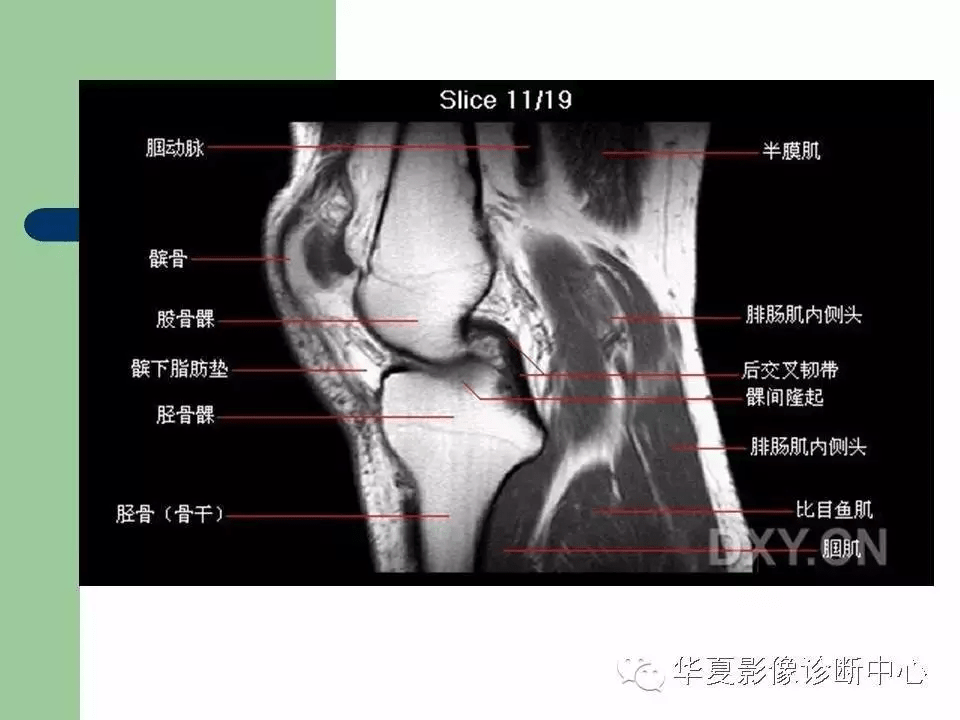 初学者必看全身大关节mri解剖膝踝肩肘全了
