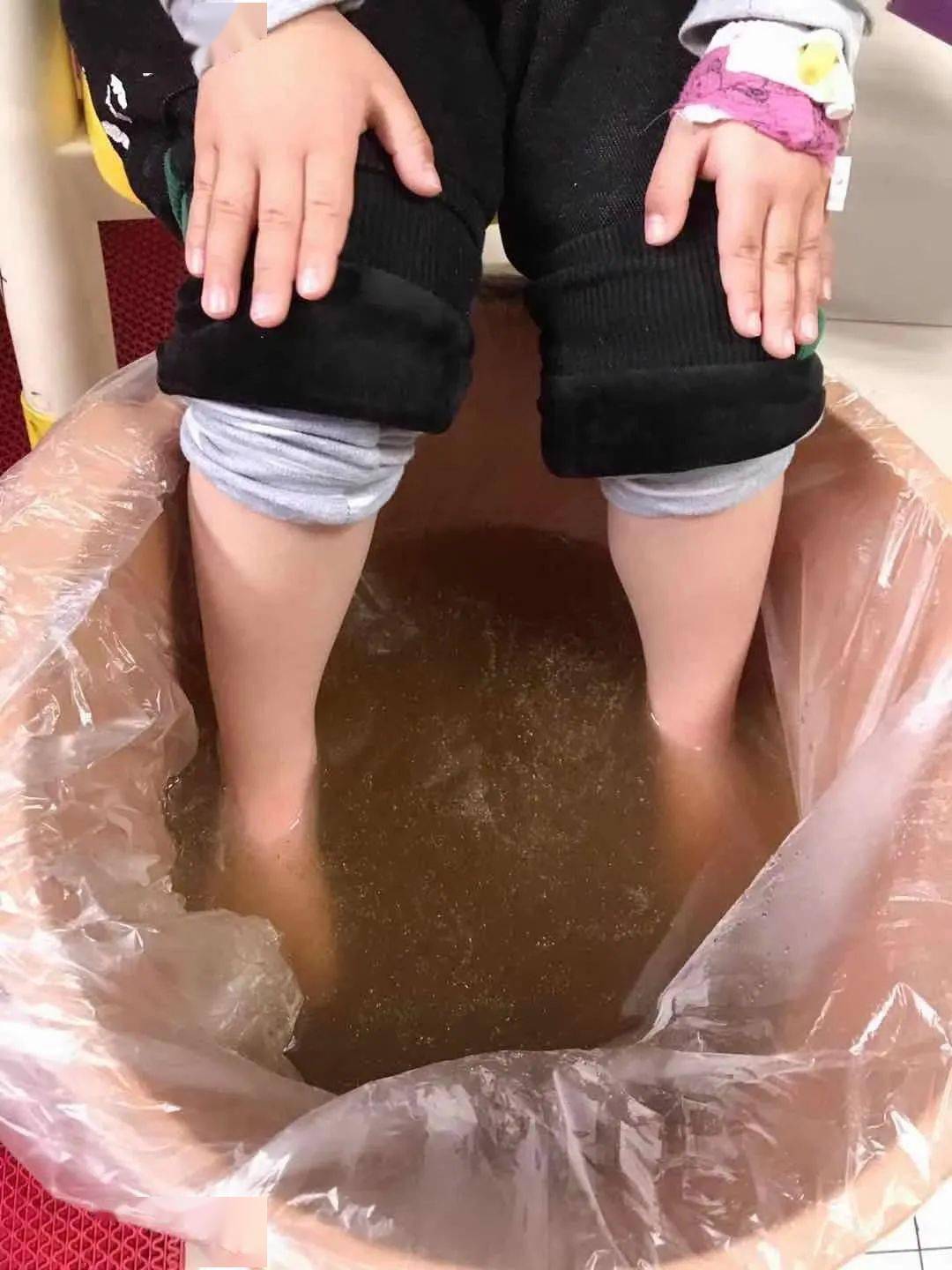 小儿感冒发烧中药泡洗显疗效