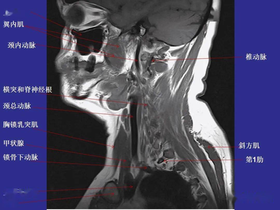 鼻骨断层解剖图片