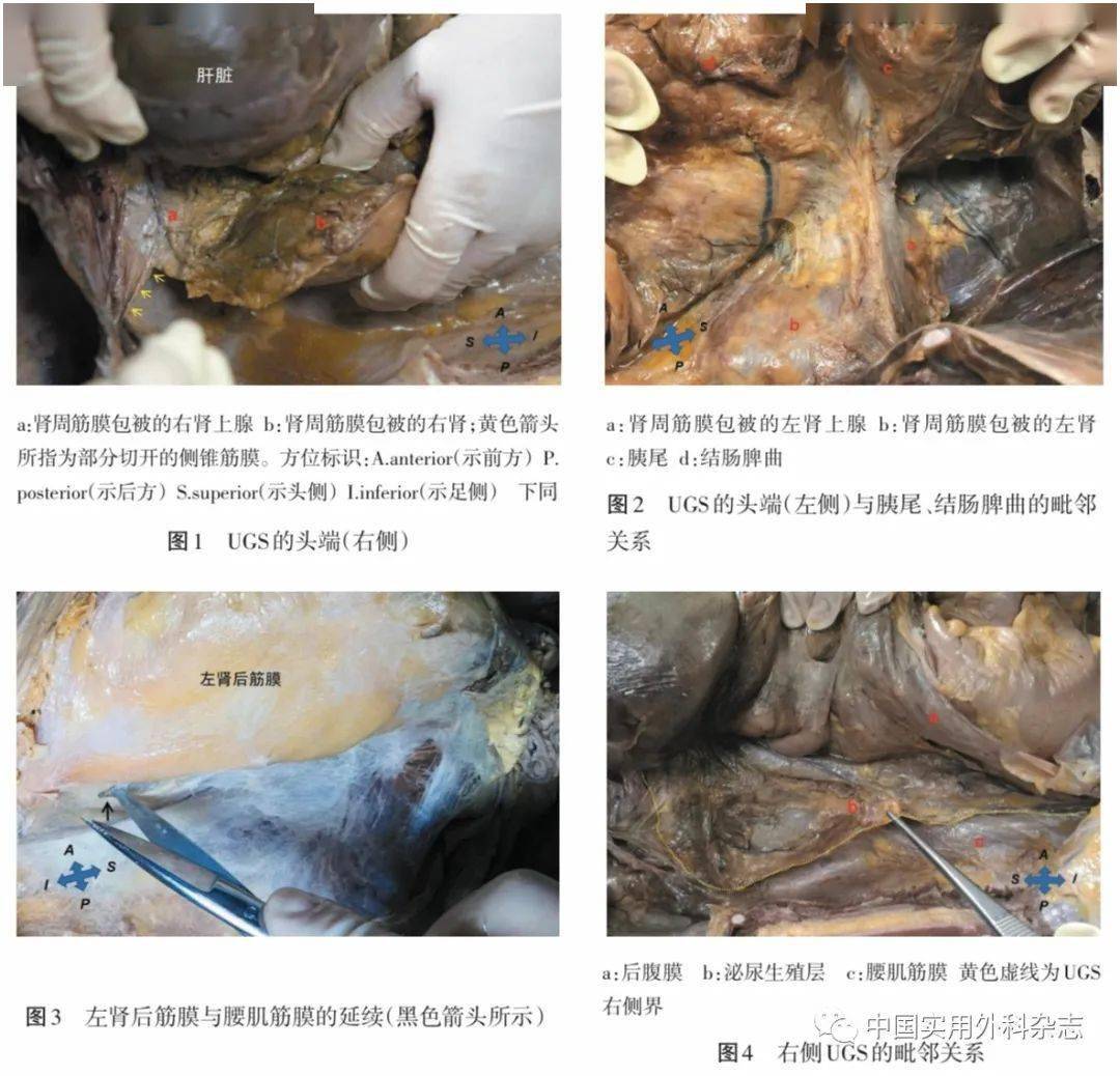 论著|男性泌尿生殖层的层面解剖及其临床意义研究_结构