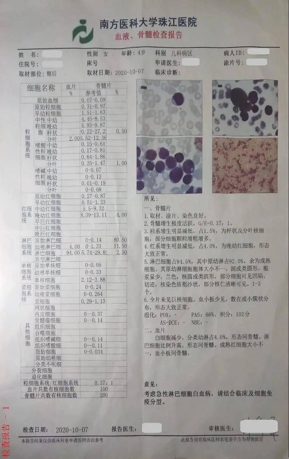 儿童白血病化验单图片