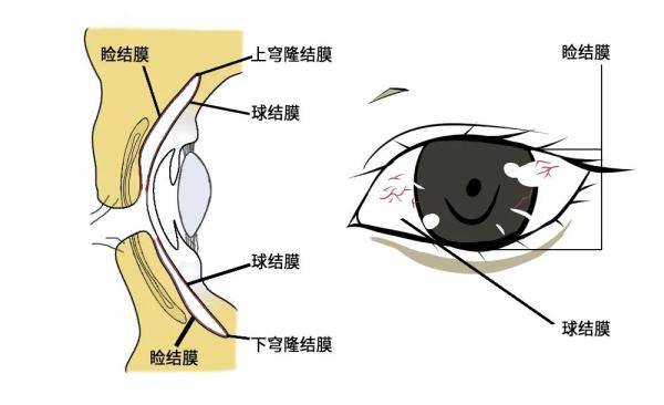 正常眼结膜图片