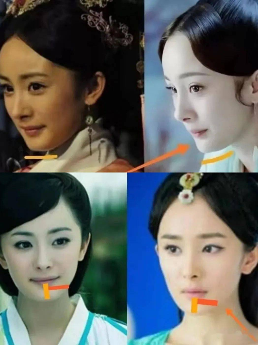 杨幂逆天改命是靠整容还是拔牙将大方脸变成小v脸的