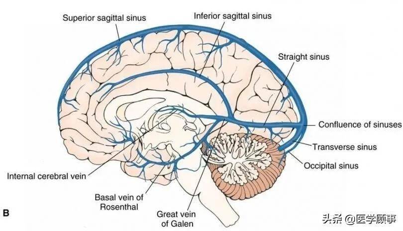 脑部静脉窦图片