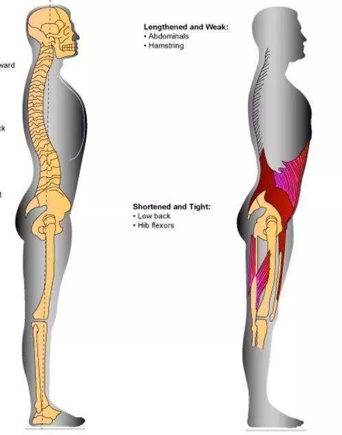 哪个不良体态偷走了女生挺拔的胸部