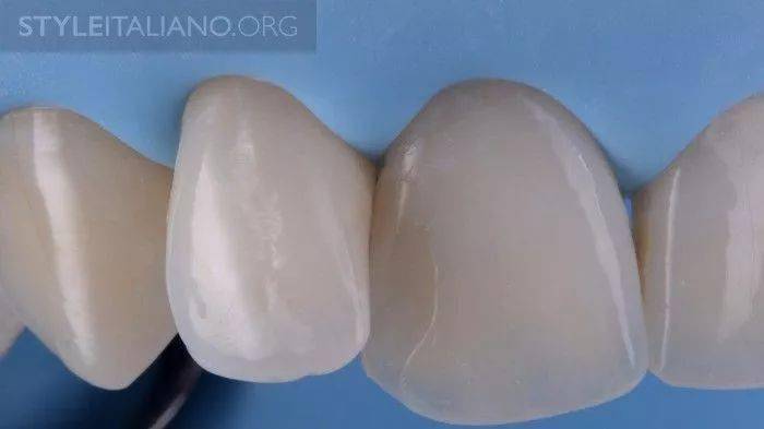 牙医学堂橡皮障翻卷的四种方法