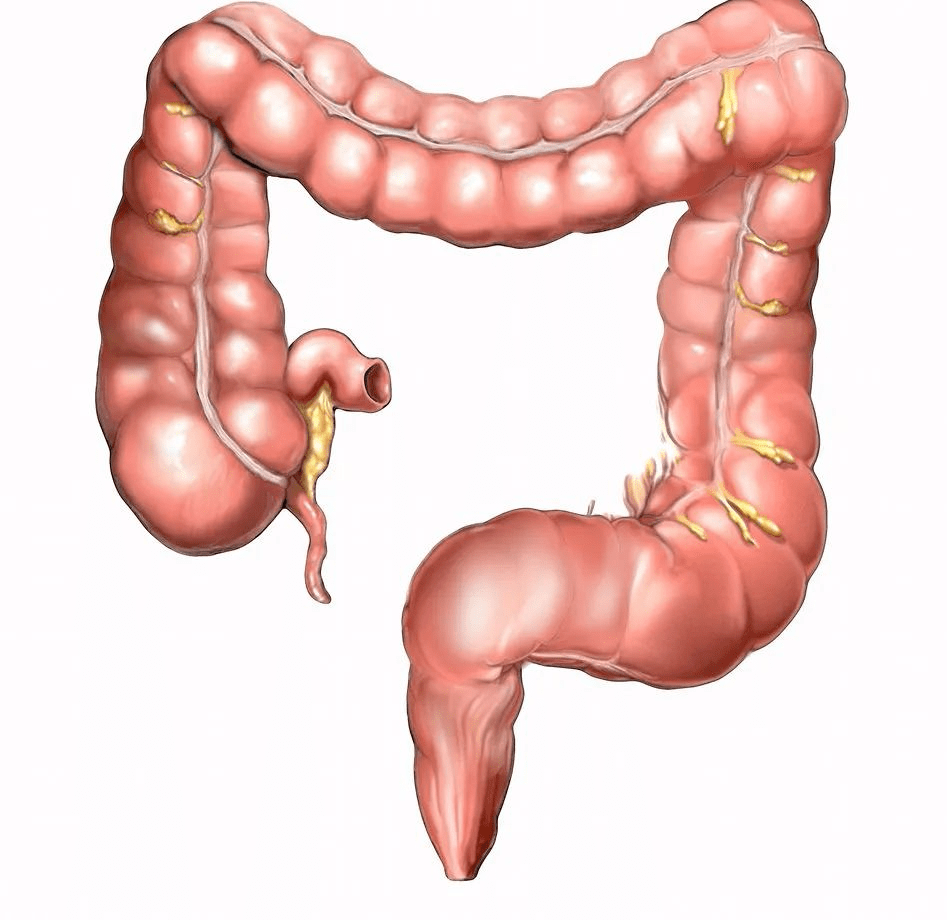 春季气温反常如大便出现2种情况要警惕一种肠道癌症