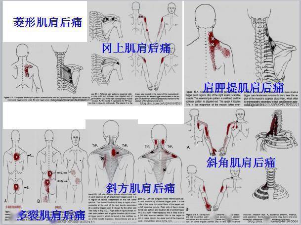 全身激痛点手册