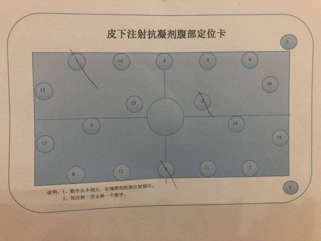 肝素打到肚脐十字位图片