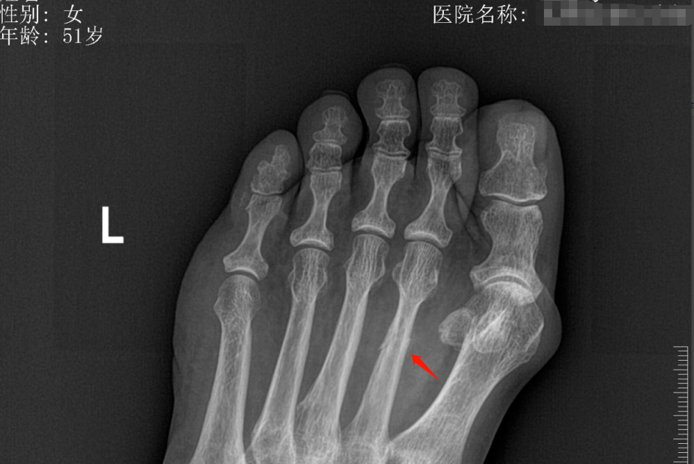 足正斜位片解剖图片