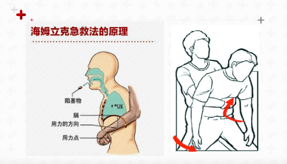 注意不要讓氣道異物成為孩童悲劇