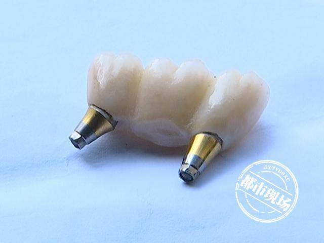 南昌老人花费5万在摩尔齿科种牙他说自己遭了罪