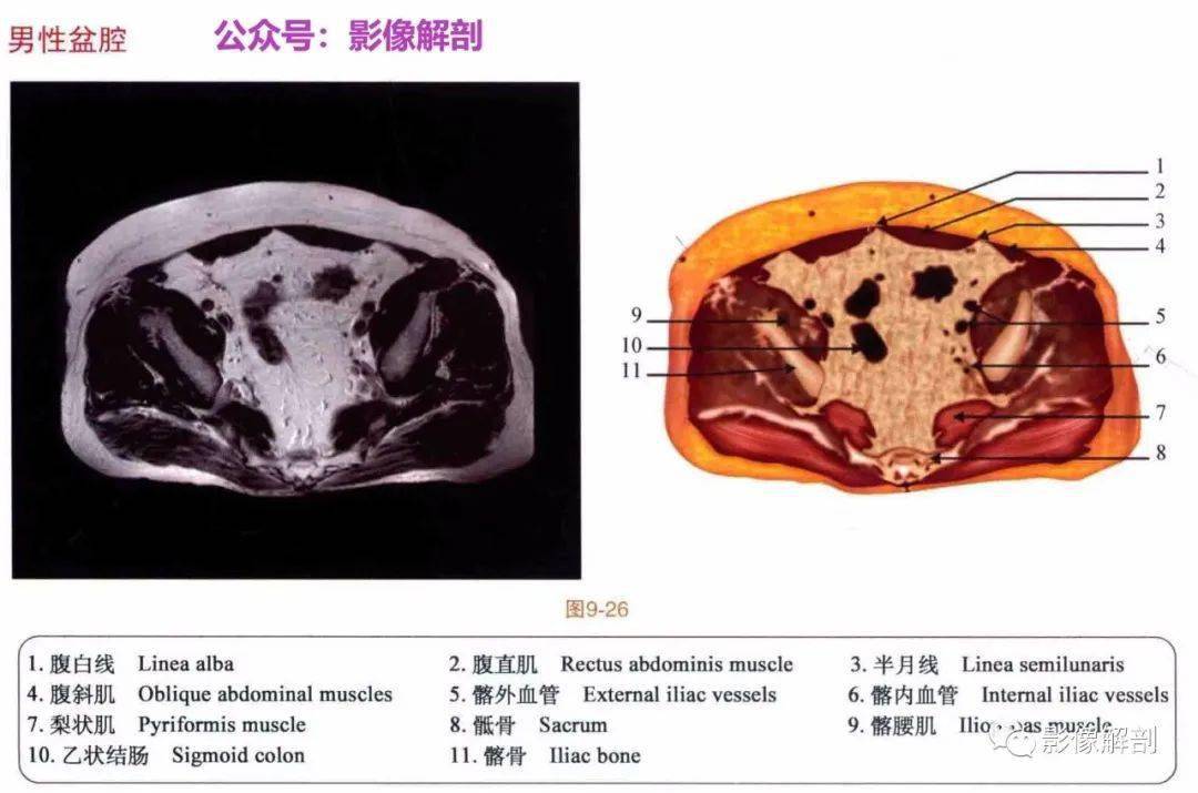 女性盆部断层解剖图片