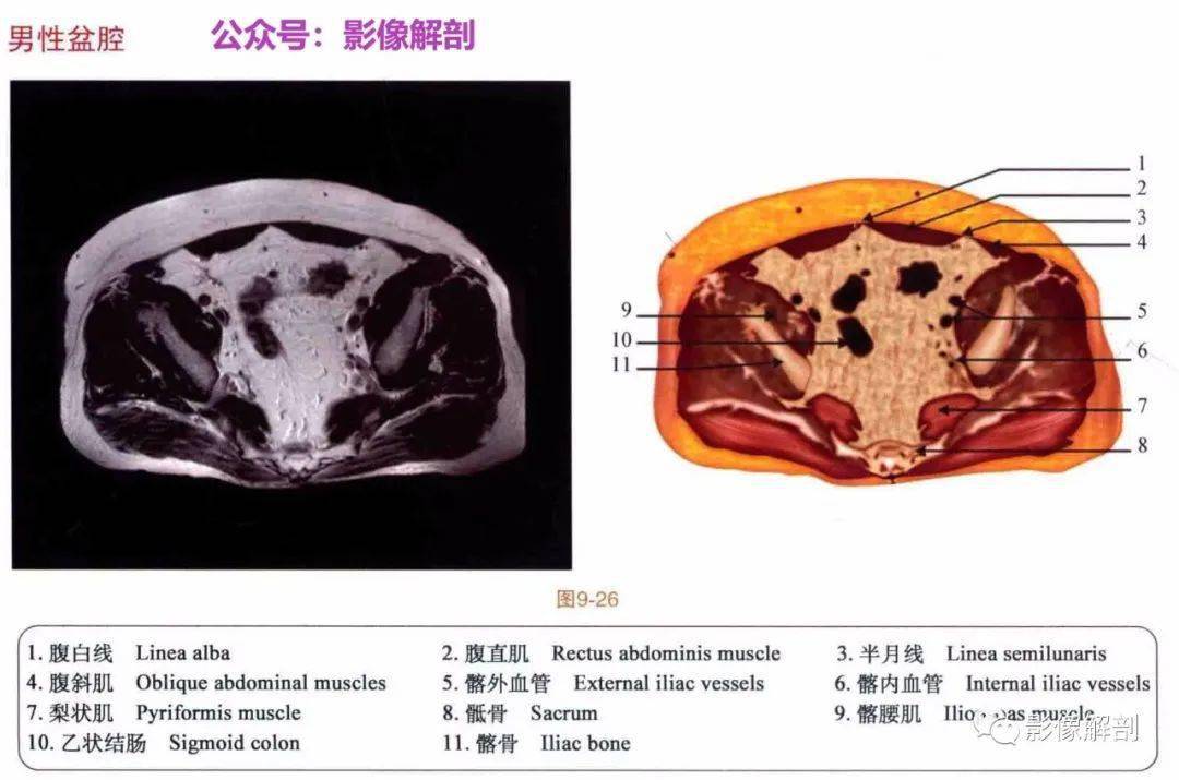 断层图谱男女性盆腔解剖图谱
