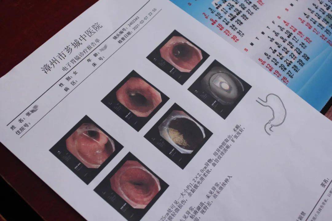 距門齒大概25釐米處可見一個白色的1.2x2.0cm呈正方形狀銳角的異物.