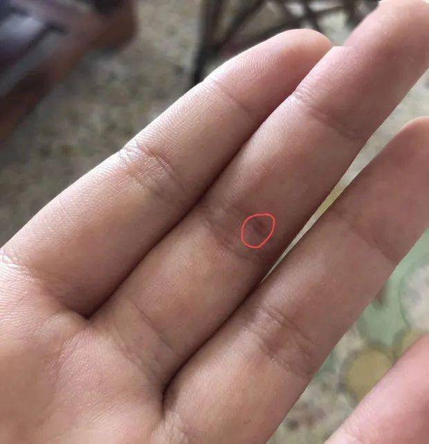 一个小大意21岁大学生屈死离世