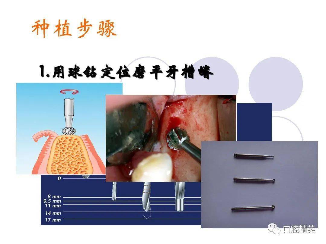 口腔科常用器械圖譜結構及功能介紹