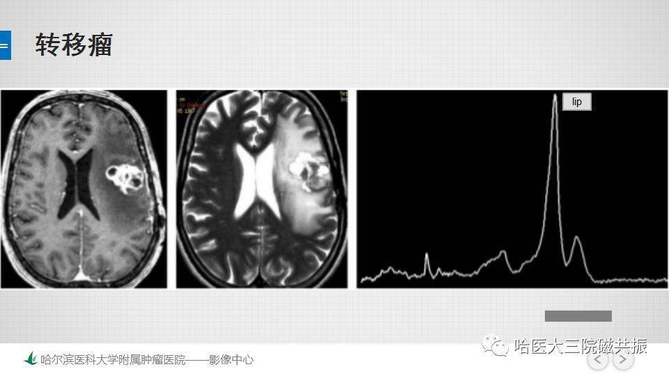 磁共振的原理是什么