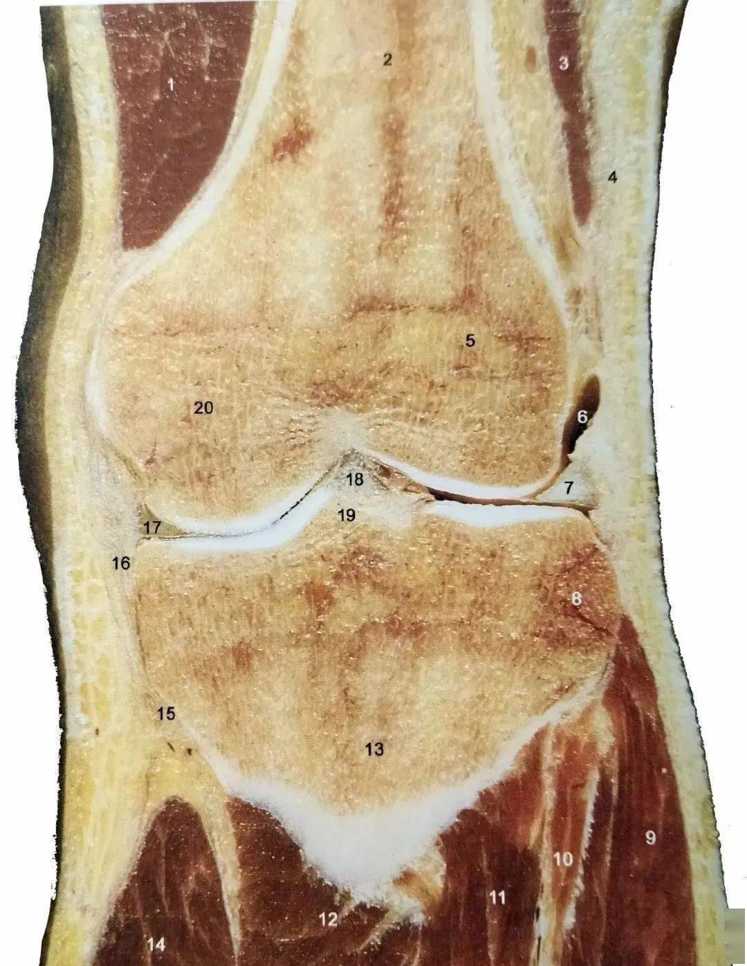 左胫骨髁间隆突图片