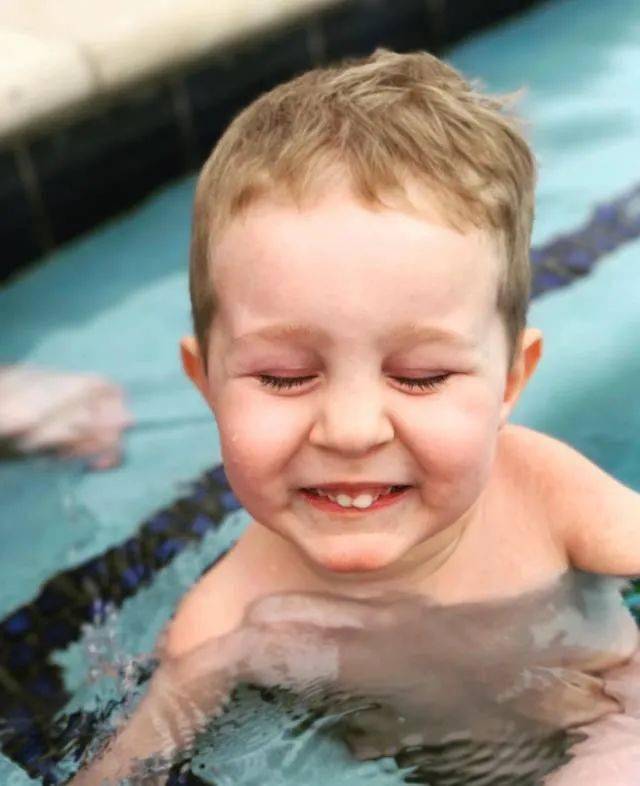 这个患有海豹肢症的孩子用他的微笑治愈了很多人今日宜乐天