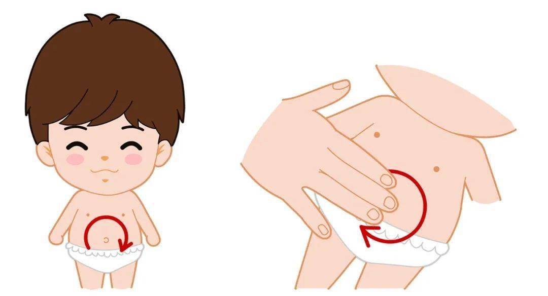 先天性巨结肠有什么症状呢?