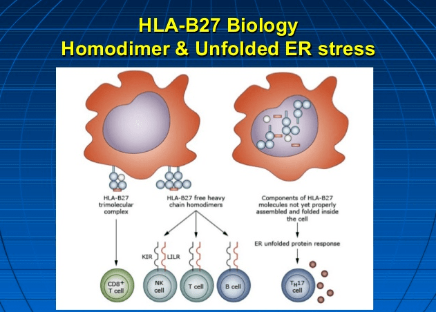 hla-b27与强直性脊柱炎的亲密关系_白细胞